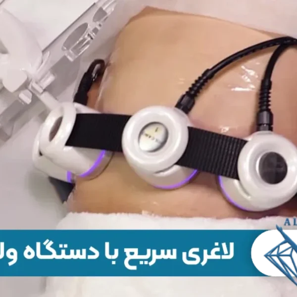 بررسی کامل دستگاه لاغری ولکانو | عملکرد، مزایا، معایب و نتایج واقعی