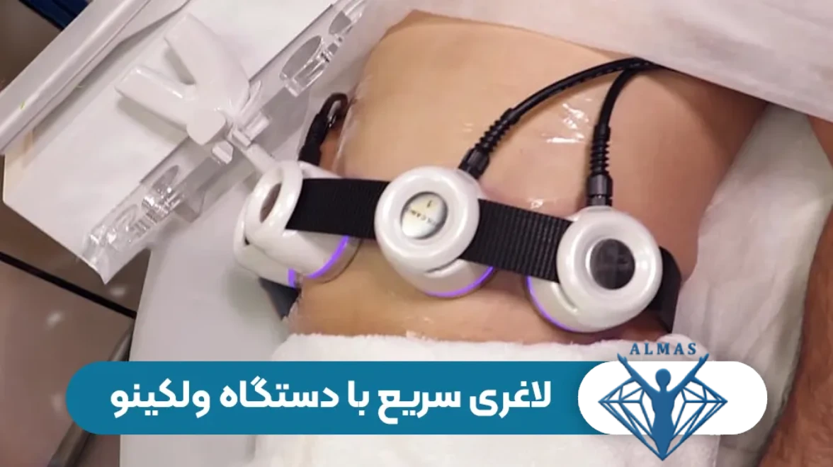 بررسی کامل دستگاه لاغری ولکانو | عملکرد، مزایا، معایب و نتایج واقعی